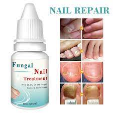 Lanthome Fungal Nail Treatment - Single